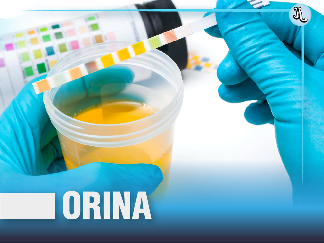Uroanálisis